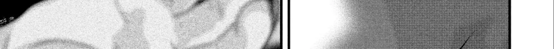 Read Dra-Q chapter 22 image 1 on Lezhin
