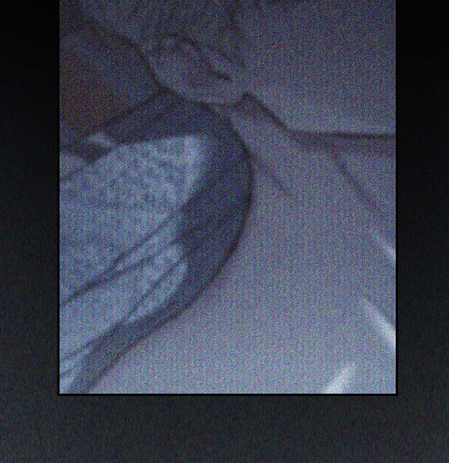Read Flashlight chapter 61.1 image 17 on Lezhin