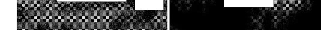 Infection Chapter 70 page 15 - 