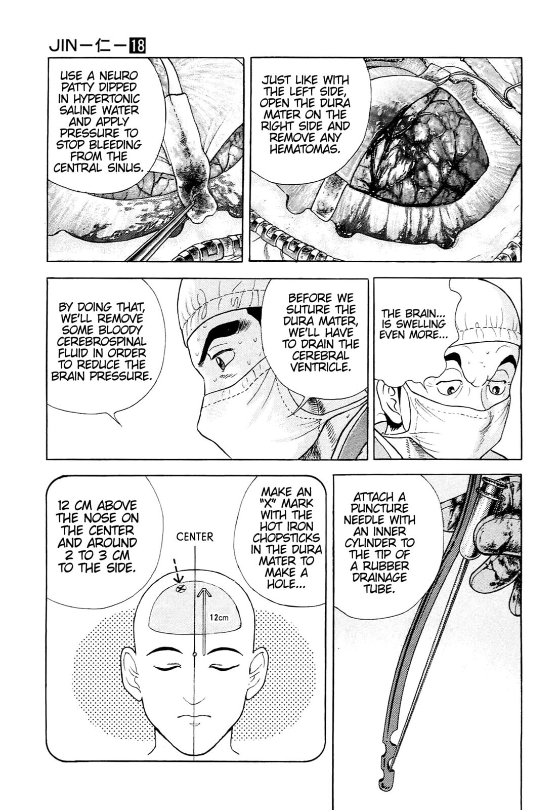 Read JIN chapter 115 image 11 on Lezhin