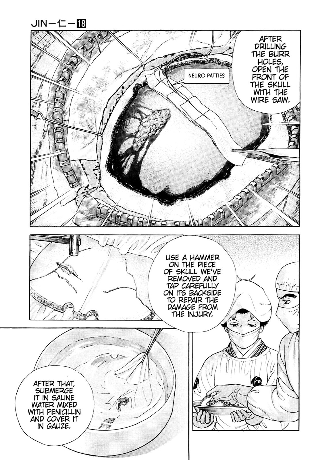 Read JIN chapter 115 image 9 on Lezhin