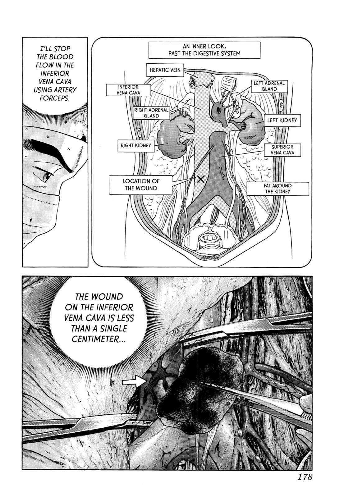 Read JIN chapter 70 image 16 on Lezhin