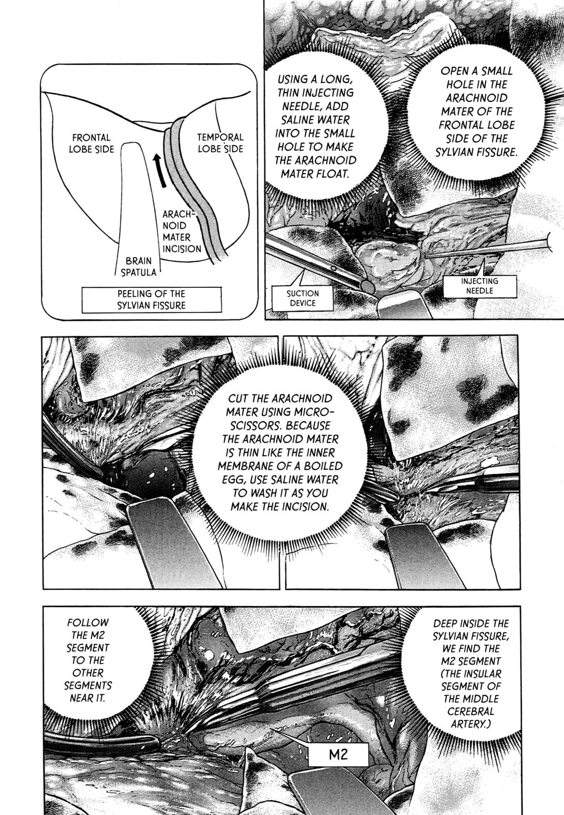 Read JIN chapter 89 image 4 on Lezhin