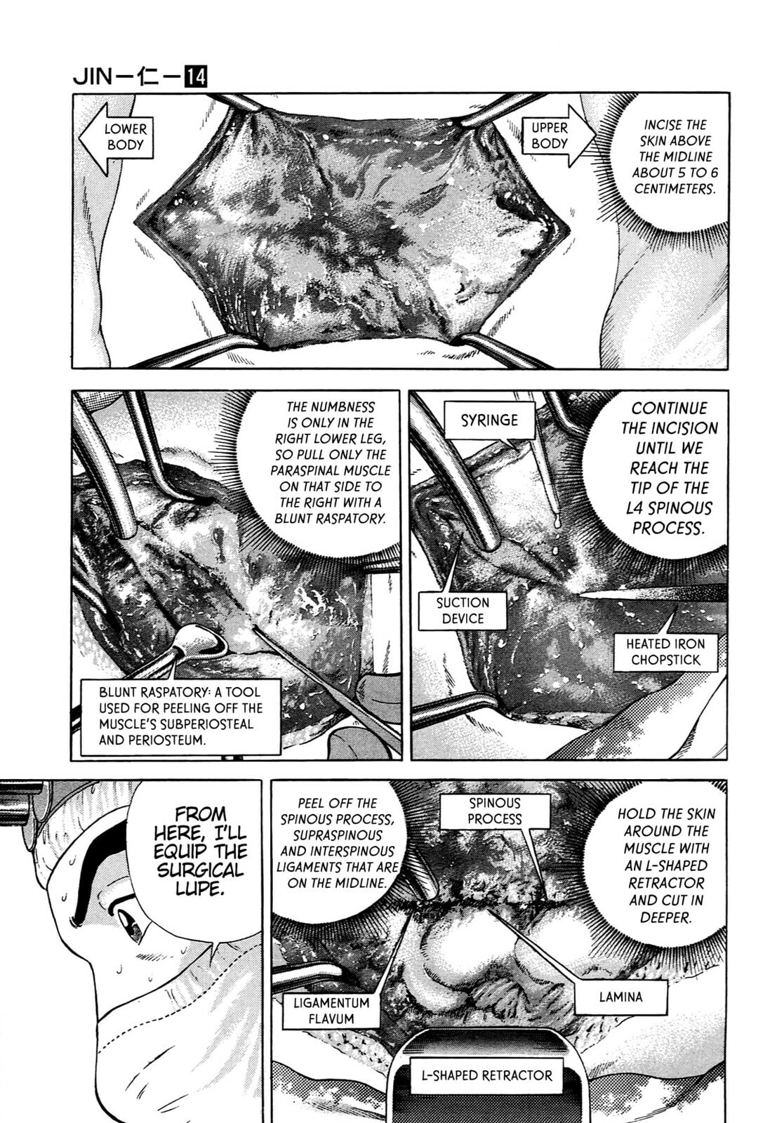 Read JIN chapter 91 image 17 on Lezhin