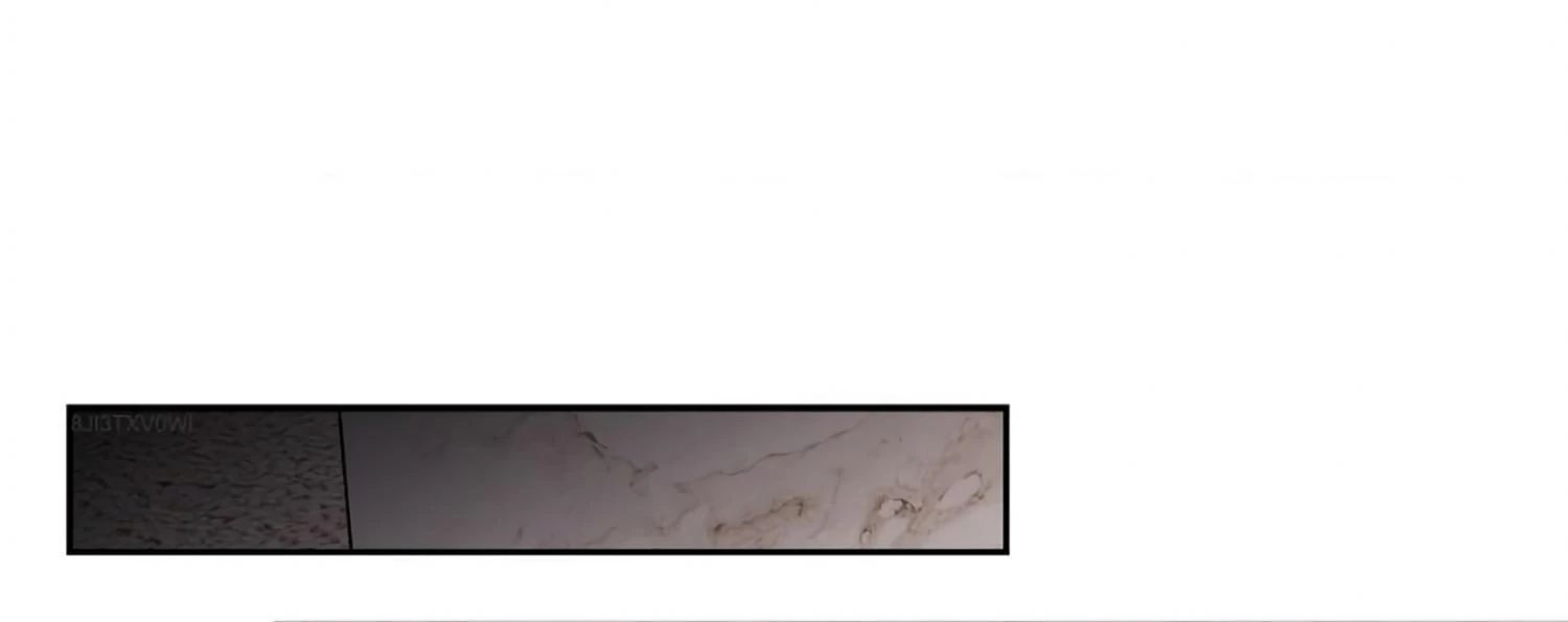 Read Placebo chapter 15 image 64 on Lezhin