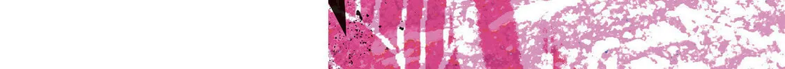 ZINGNIZE Chapter 31 page 4 - 